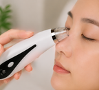 Electric Blackhead Remover Vacuum – USB Rechargeable Facial Pore Cleaner & Acne Extractor with Strong Suction for Deep Cleansing